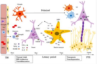 The Role of Neuroinflammation in Post-traumatic Epilepsy